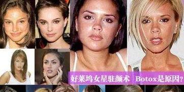 明星爆料打肉毒素视频,真实打肉毒素过程大公开